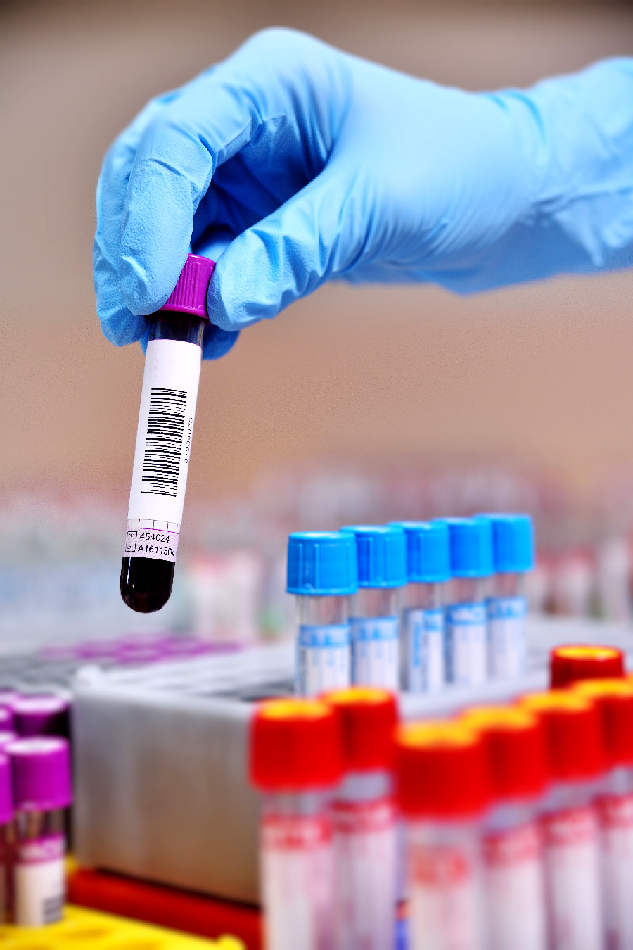 Prélèvement sanguin réalisé au laboratoire TALBORJT LAB à Agadir